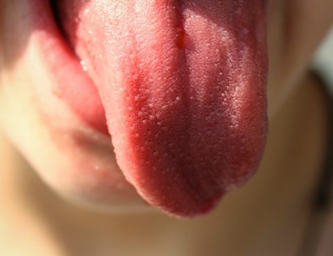 cáncer oral