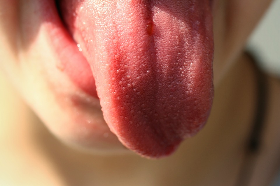 cáncer oral